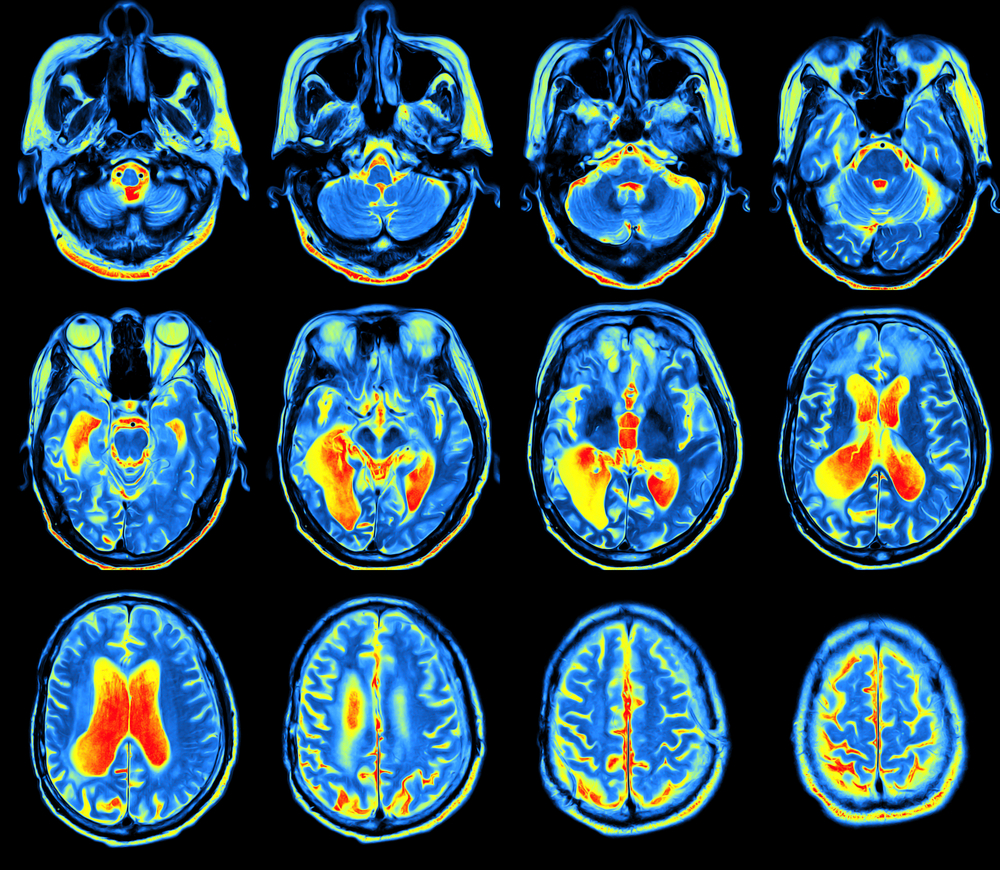 what-is-nuclear-imaging